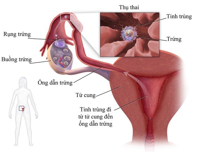 Bà bầu mặc áo đỏ chảy máu