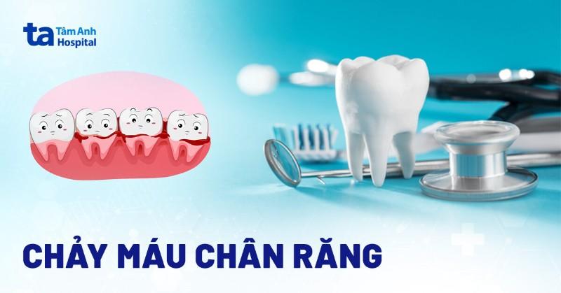 Chảy máu chân răng khi đánh nhau