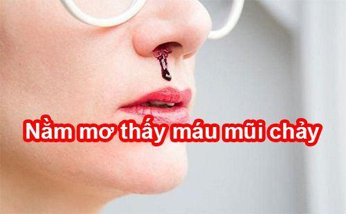 Nằm mơ thấy chảy máu mũi đánh con gì?