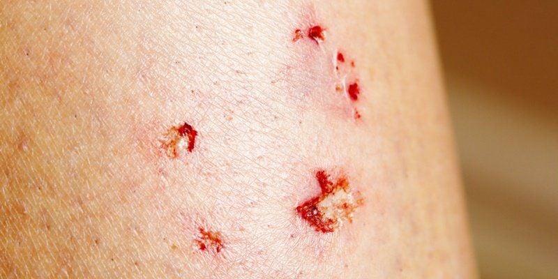 Chó cắn chảy máu điềm báo gì?