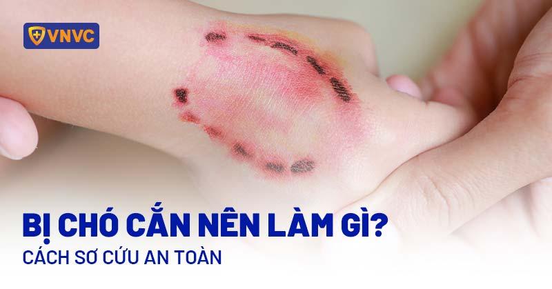 Giải Mã Giấc Mơ Thấy Bị Rắn Cắn Đánh Con Gì?