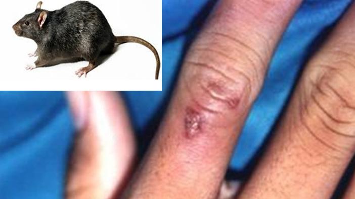 Giải Mã Giấc Mơ Thấy Giết Rắn 2 Đầu và Số Đề Liên Quan