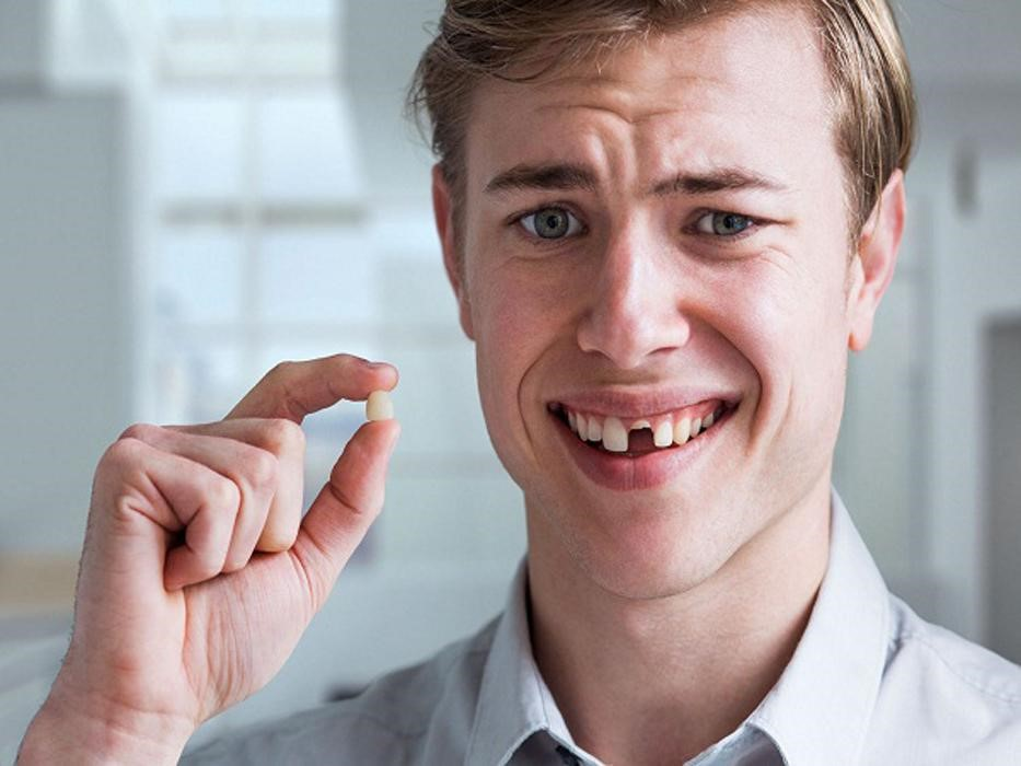 Giải mã giấc mơ gãy răng của mình