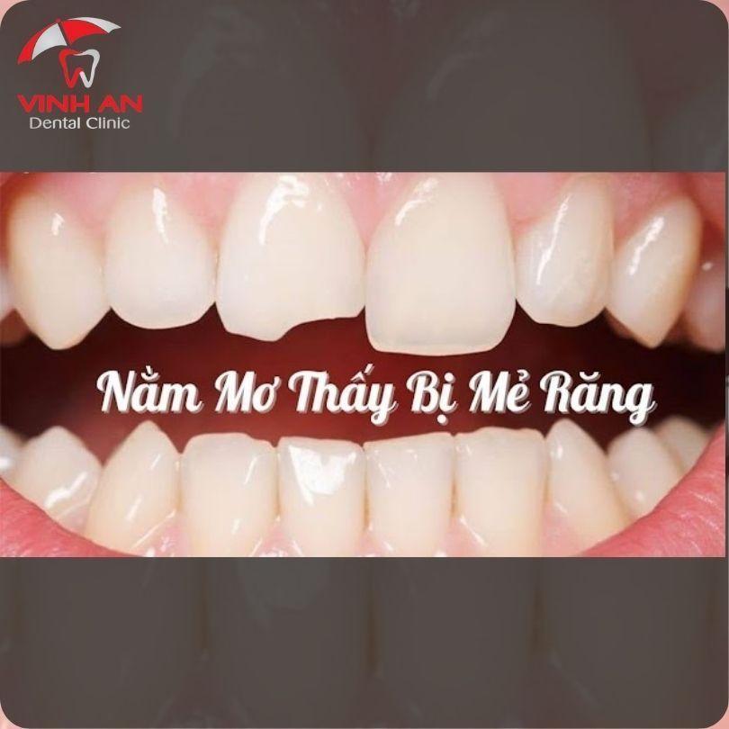 Giải mã giấc mơ mẻ răng chảy máu