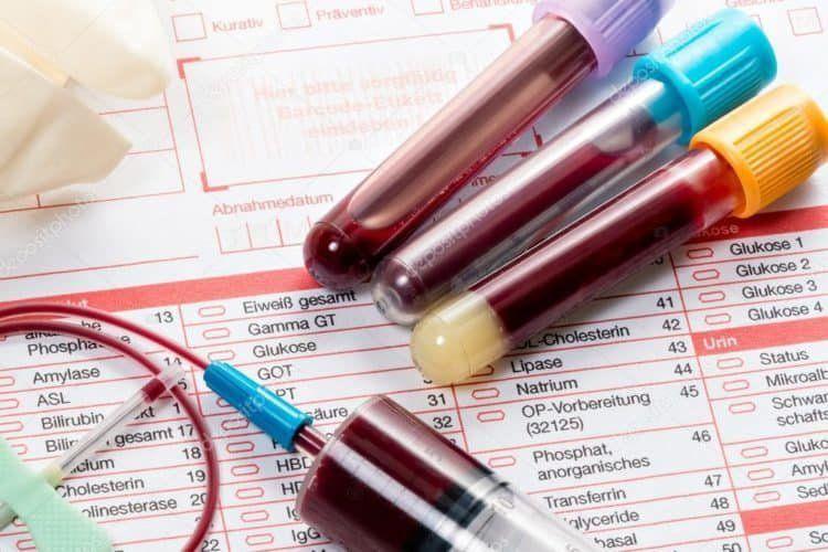 Có Bầu Nằm Mơ Thấy Cá Chép: Điềm Báo Gì Về Số Đề?