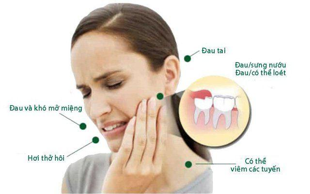 Nằm Mơ Thấy Rụng Tóc Hói Đầu Đánh Con Gì?