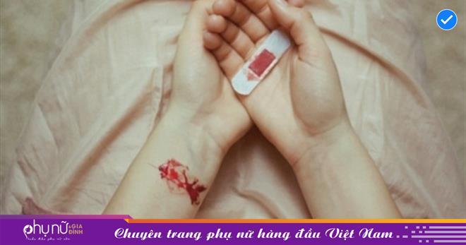 Nằm mơ thấy đứt tay người khác