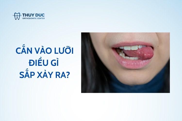 Nằm Mơ Thấy Vòng Đeo Tay Đánh Con Gì?