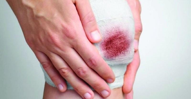 Nằm Mơ Thấy Cá Đánh Con Gì? Giải Mã Chi Tiết