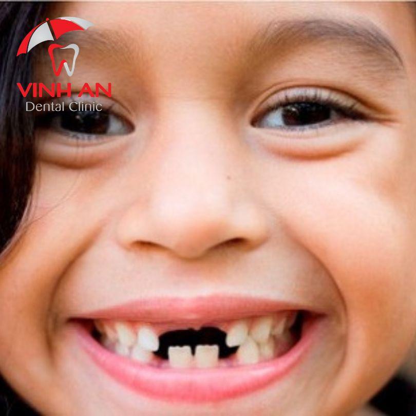 Giải Mã Giấc Mơ Thấy Người Yêu Cũ Ôm Hôn Mình và Số Đề Liên Quan
