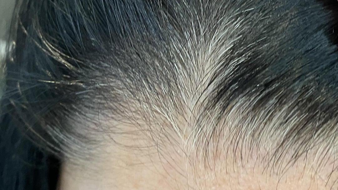 Giải Mã Giấc Mơ Thấy Bị Bệnh Phụ Khoa Và Con Số May Mắn