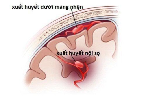 Nhện trắng giữa mạng nhện
