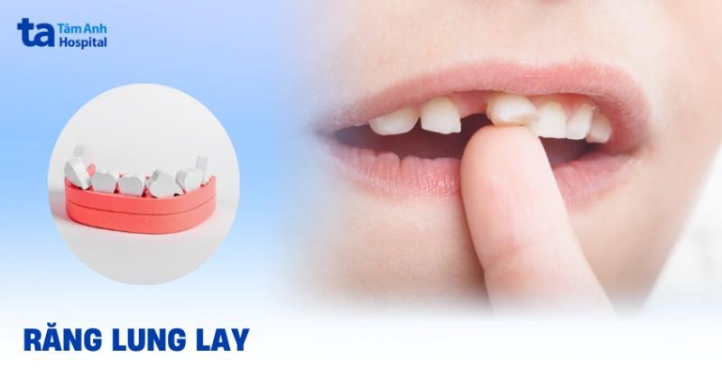 Giải Mã Giấc Mơ Nhổ Răng Sâu Đánh Con Gì?
